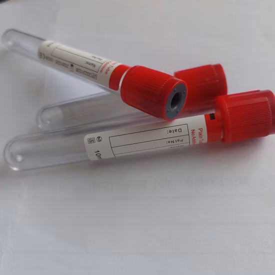 Chengwu Medical 10ml Viral Transportation Medium Tube for PCR Test